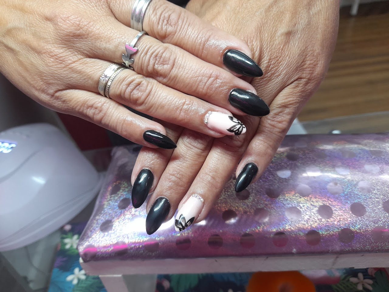Trabajo realizado en Star Estética San Miguel